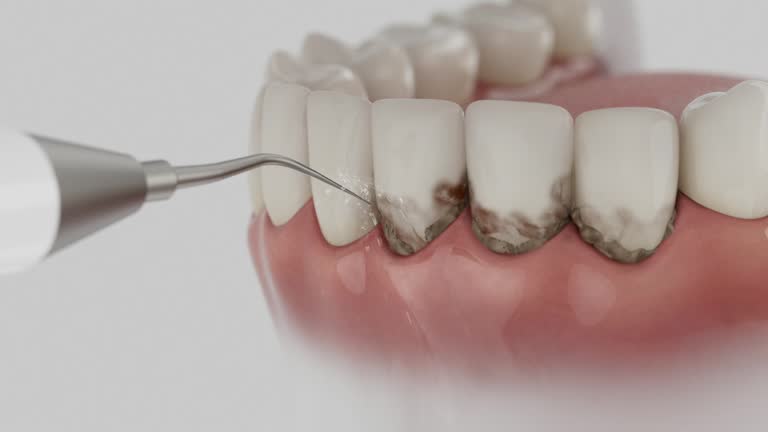 Reliable Dental contractor in Splendora, TX by Smile Center Dentistry